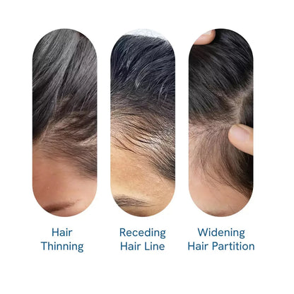 Rosemary Roll-On Hair Growth Serum